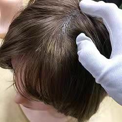 Hair transplant with high-temperature wire